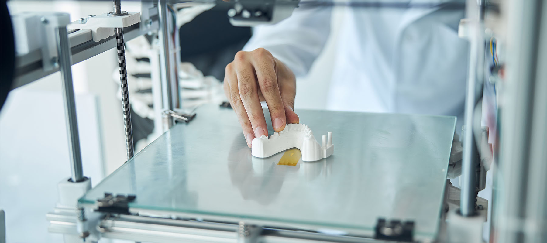 Fay Hu General Dentistry | SureSmile reg  , Digital Impressions and Preventative Program