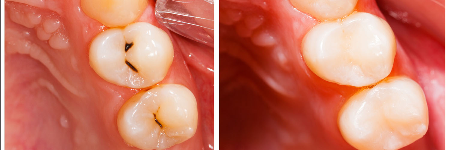 Fay Hu General Dentistry | Oral Exams, Facial Services and Dentures