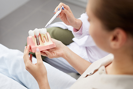 Fay Hu General Dentistry | Juvederm reg , Digital Radiography and Crowns   Caps