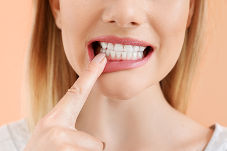 Fay Hu General Dentistry | Emergency Treatment, Sports Mouthguards and TMJ Disorders